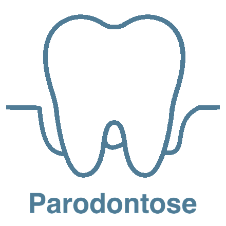 Parodontose Tandlægerne Classensgade
